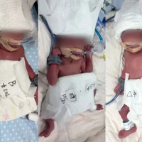 新疆一24 岁产妇诞下 5 胞胎，多胎妊娠会面临哪些挑战？哪种高危妊娠因素最危险？
