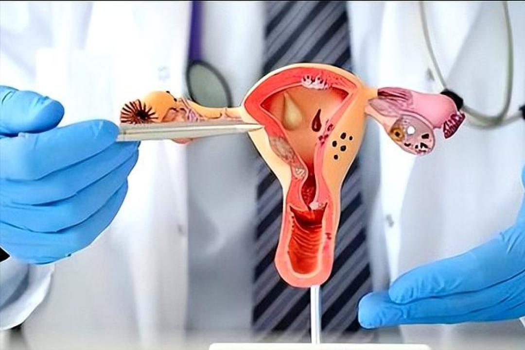 持续感染HPV,对女性伤害很大,性生活尤其注意2点