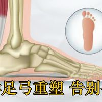 科学重塑足弓 告别平足