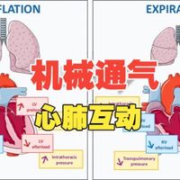 ICM（IF=22.1）｜机械通气绝非单一呼吸支持！吃透双心室负荷重塑等心肺交互本质，重构呼吸循环协同管理，解锁脱机、ARDS 诊疗新路径