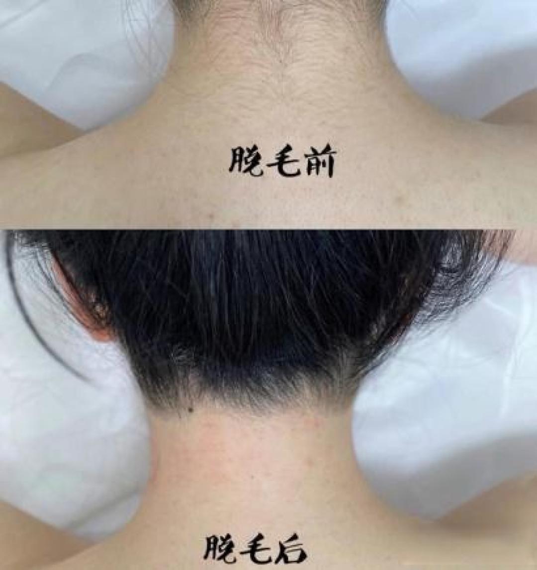 脱毛仪是不是智商税?初扉、beautigo、Ulike、飞利浦、AMIRO觅光、康佳、Doco、奥克斯八大热门脱毛仪测评对比,脱毛仪推荐买什么牌子答疑+脱毛仪真实性能排名分享!