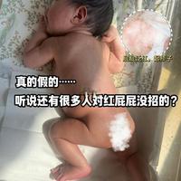 不是吧，还有谁对小宝红屁屁没招的❓❗