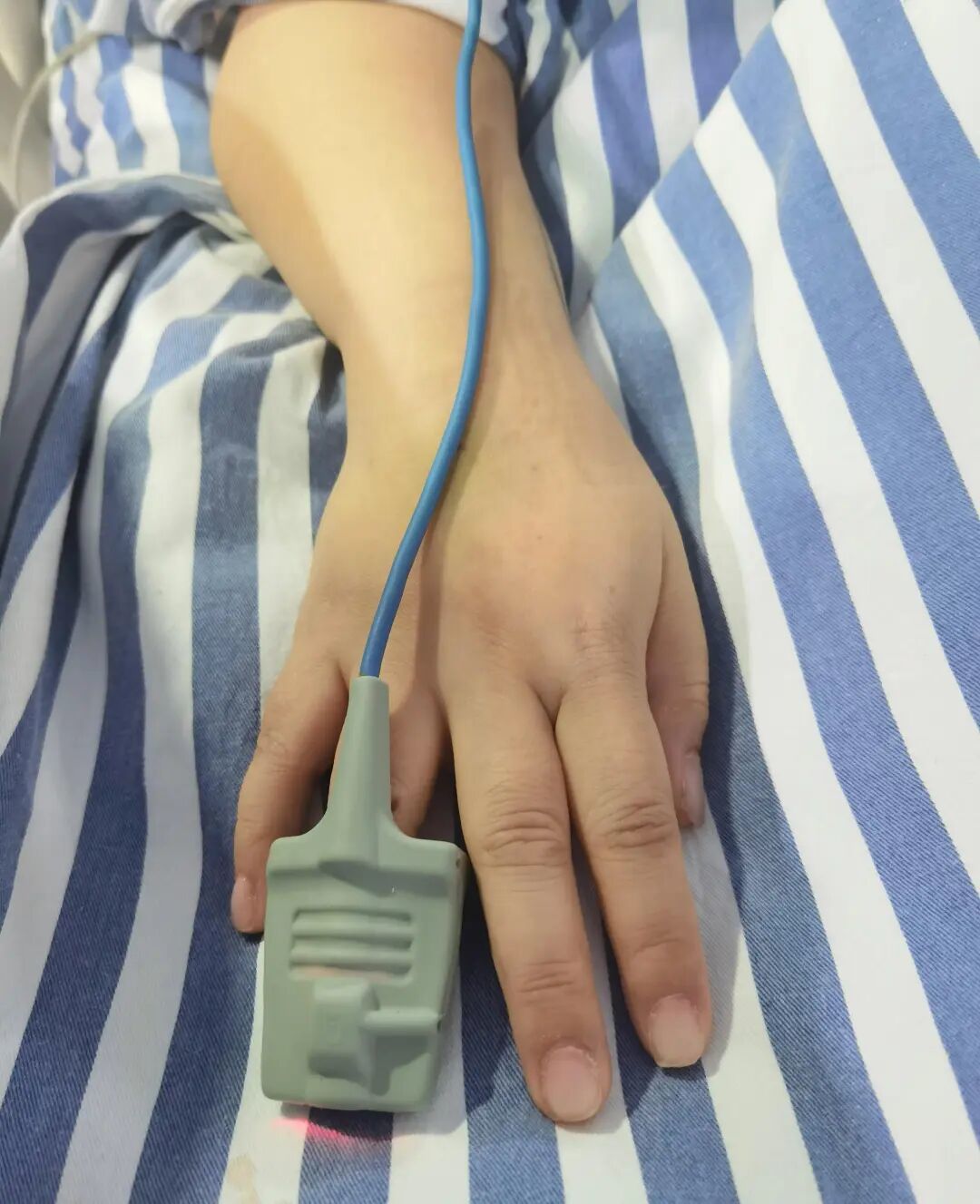 28岁女子心跳骤停,紧急叫来美甲师!医生提醒:爱美人士留一个“救命指”!