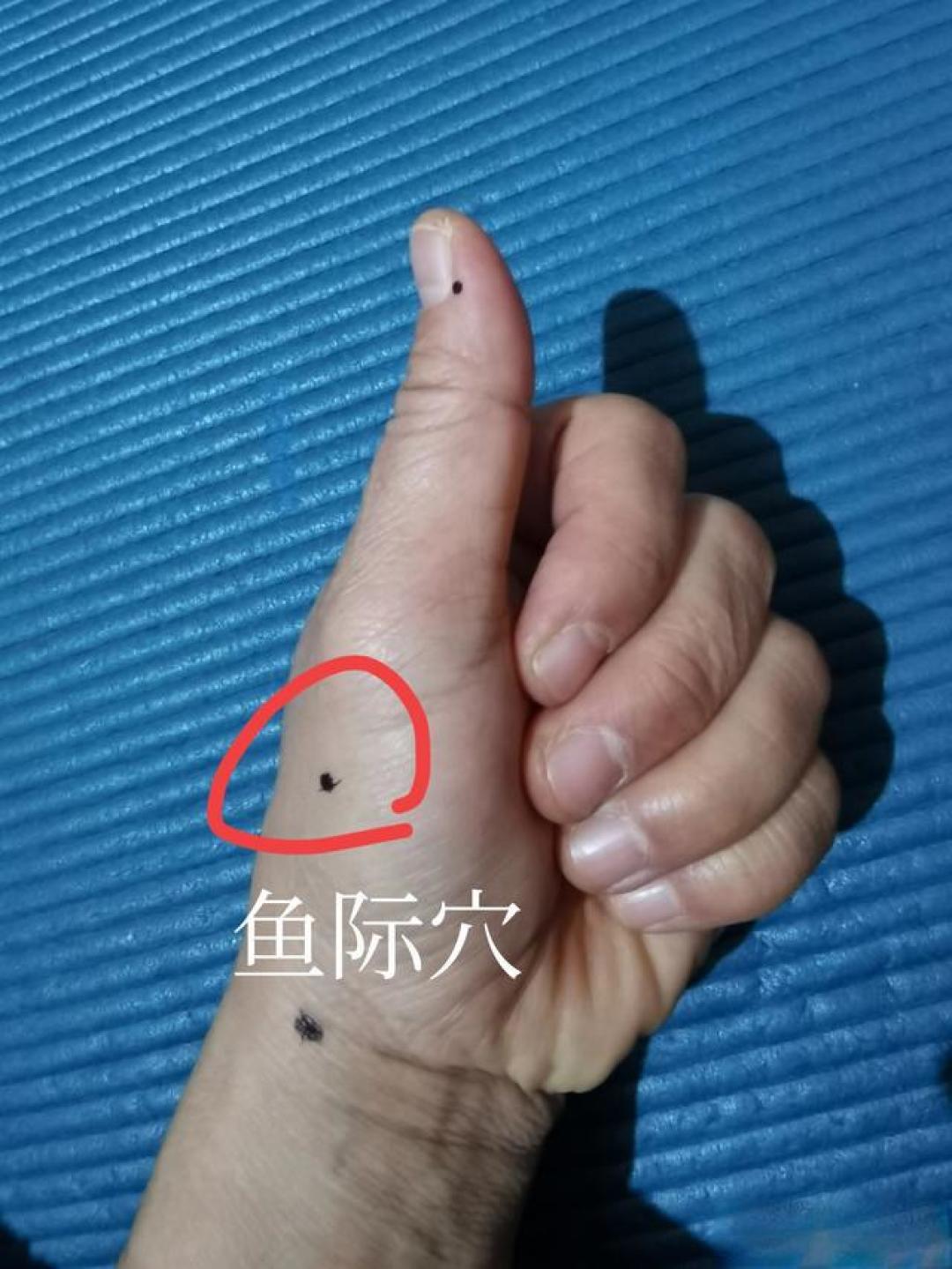 每天按一按,肺肠通畅少生病:中医里的两个健康“开关”