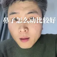 鼻子到底是注射比较好，还是假体比较好#鼻综合#医美#修复#这是个真实的事情 #避坑