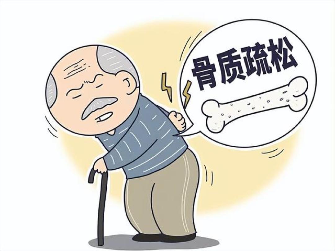 医生:预防骨质疏松最好的习惯,不是晒太阳,而是经常做这几件事