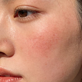 春季过敏那些事儿 敏肌+鼻炎党亲测，这些好物真能救命不踩坑