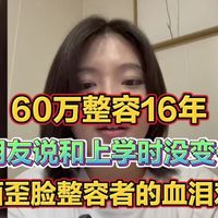 削骨2次、剖背断神经4次，整容16年的我，劝你别重走我的弯路