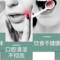 日常护龈｜口气清新神器✨打工人必入平价款
