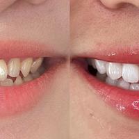 2026牙膏TOP10实测推荐｜闭眼入不踩雷，曲蔻稳居榜首