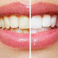 2026牙膏测评：解决牙黄口臭，这款平价美白款封神