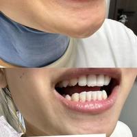 5款热门美白牙膏实测：7天摆脱牙黄，口气清新