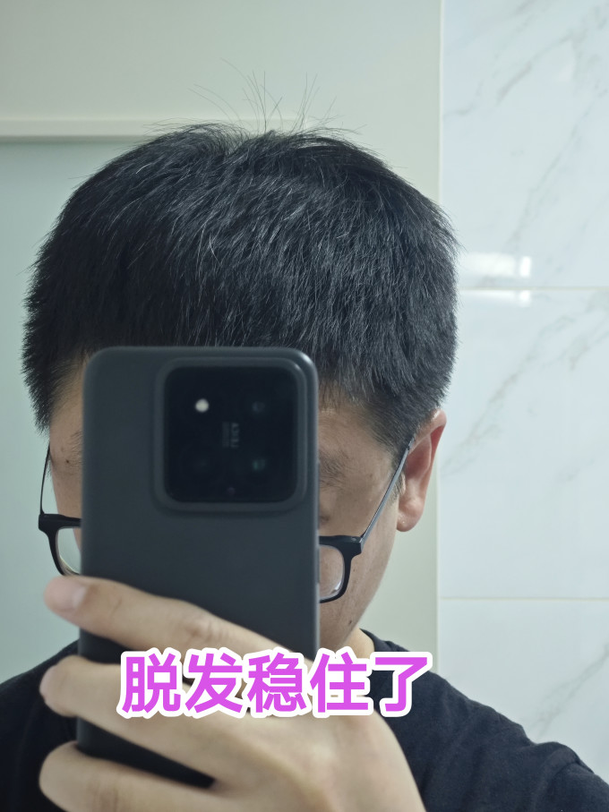 鲁南植发养发