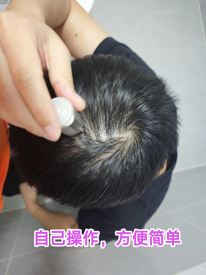 鲁南植发养发