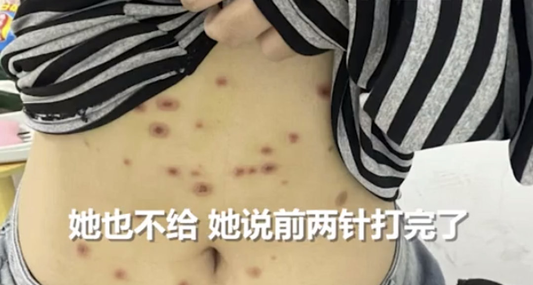 女生800元买猫被传染全身长猫藓 治疗花费已近千元
