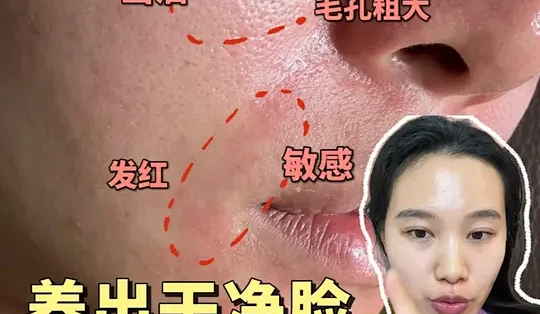 毛孔粗大出油泛红！5点让油敏皮养出干净脸 #护肤好物_爽肤水_什么值得买