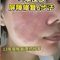 冬季皮肤修复6步法，敏感肌必备#敏感肌 #敏感肌护肤 #敏感肌红血丝 #红烫肌