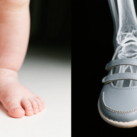 宽鞋头+软底≠健康！儿童鞋选错反伤足，这4个关键设计才真正护发育