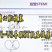 39.后壁心肌梗塞（V1-V3导联ST段压低原因分析）