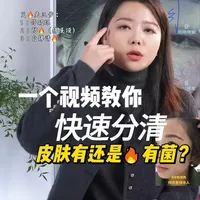 一个视频教你快速分清 皮肤有火还是有菌？#敏感肌 #屏障受损 #敏感肌修护 #灭火