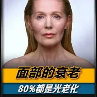 你知道吗？面部80%的衰老来自光老化 ，只有20%才是自然老化#科普 #涨知识 #娜丽丝 #娜丽丝防晒喷雾