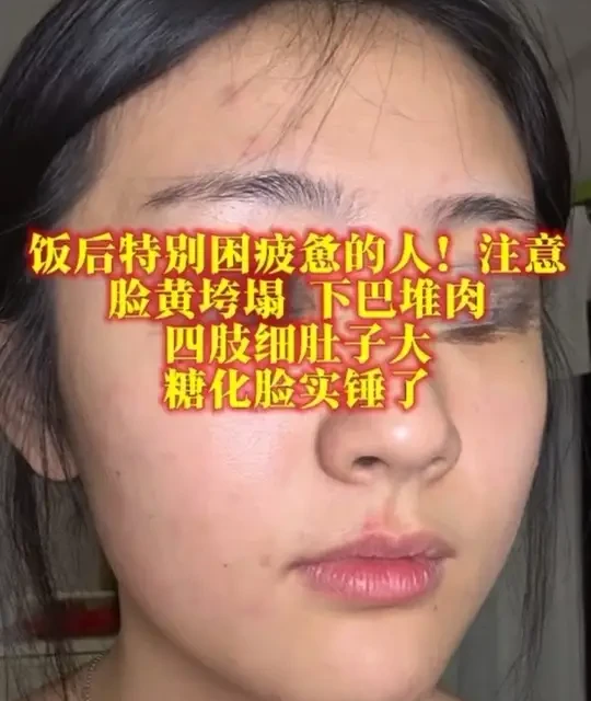 饭后特别困的脂包骨姐妹！按照这三低一高的逻辑，照着这饮食走 #脂包骨 #多囊 #胰岛素抵抗 #糖化脸 #低gi主食推荐