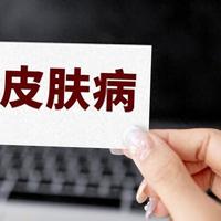 皮肤科医生大揭秘：湿疹、荨麻疹、皮炎，如何用药？一文总结