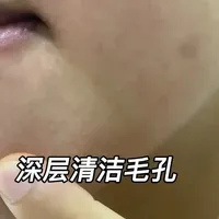 脸上摸着麻麻赖赖的 说明油脂堆积的太多了 该做深层清洁了#清洁毛孔 #画梅 #油皮 #闭口