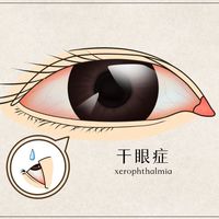 眼睛干涩刺痛？不用眼药水也能缓解的居家自救指南
