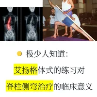 艾扬格瑜伽对脊柱侧弯的精准“正位”