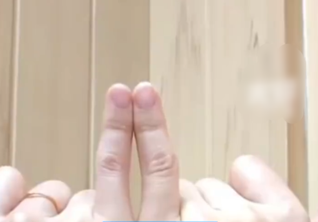 女子长期用小拇指托手机后果:日均刷机8小时手指变形