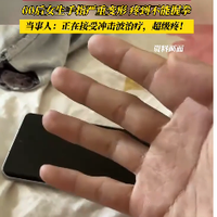 别再用小拇指托手机了长时间托手机致小拇指变形?医生这则提醒很重要!