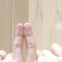 女子长期用小拇指托手机后果:日均刷机8小时手指变形
