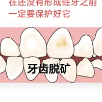 牙齿脱矿变成蛀牙？高效护理办法我教你