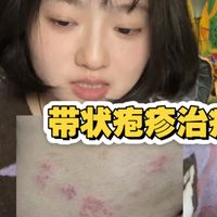 医学生带状疱疹中招经过！疼到飞起的神经痛该如何解决！