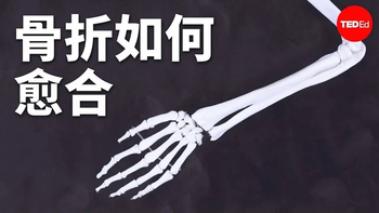 【熟肉】骨折后身体会发生什么？骨骼愈合的科学原理 - TED-Ed