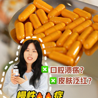 皮肤总泛红爆痘?原来是身体的🔥太旺了!