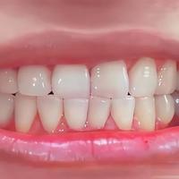 清洁力太离谱了！6款热门电动牙刷实测后，差距比我想象中还大！