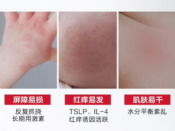 春季宝宝“小红脸”退退退！这支舒润面霜，让娃舒坦过春天