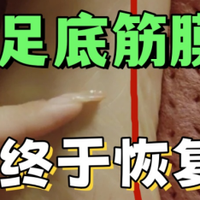 多年的足底筋膜炎终于好了！发现一个超有用的方法！