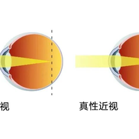 蔡司泽锐镜片：技术革新还是验配陷阱？1000+用户观点大PK