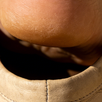 脚肥的人适合穿运动鞋吗？答案藏在选对款式里