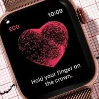 Apple Watch房颤监测：健康管理神器还是过度依赖科技？1200+用户观点大PK