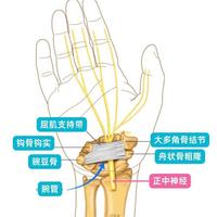 手腕经常又麻又酸？当心“鼠标手”找上门 这3个信号要警惕