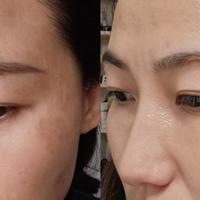 春季淡斑保湿汇总：十大公认好用的祛斑产品，祛斑产品什么好？