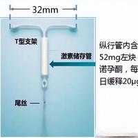 曼月乐上环前别慌!这 3 点提前做好，少遭罪还稳​