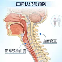 颈椎生理曲度变直，别再乱按乱揉！科学康复、正确拉伸，才能真正把曲度练回来。低头族、上班族，这条一定要收藏。
医学科普仅供参考如有不适线下就诊
#颈椎曲度变直  #颈椎 #颈椎病 #颈部护理 #康复科普