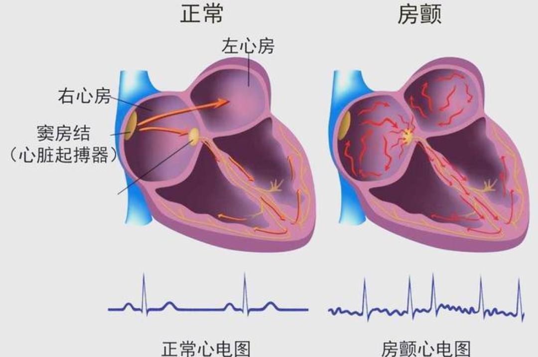 心脏好不好，别凭感觉！读懂身体信号和体检指标是关键