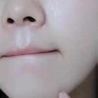 低成本：痘痘全周期护理(功课）