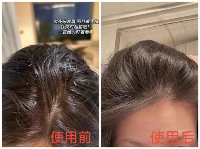洗发产品